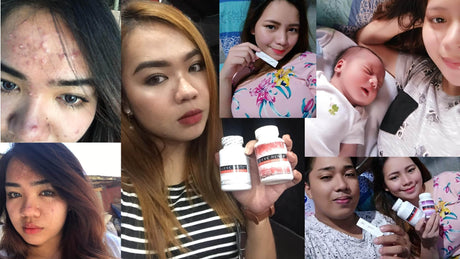 glutathione helps pcos does help with Nutritional and herbal interventions for polycystic ovary syndrome (PCOS): a Glutathione ba is good for